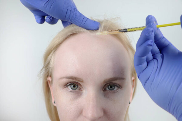 Hair mesotherapy or hair transplant: a beautician doctor makes injections in the head of a woman for hair growth or to prevent baldness