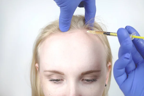 Haar Mesotherapie Haartransplantatie Een Schoonheidsspecialiste Arts Maakt Injecties Het Hoofd — Stockfoto