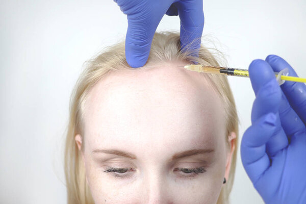 Hair mesotherapy or hair transplant: a beautician doctor makes injections in the head of a woman for hair growth or to prevent baldness