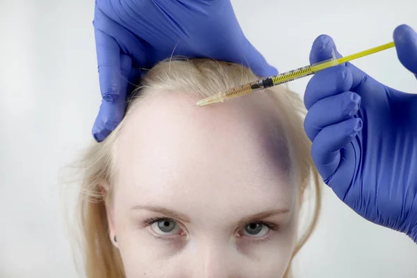 Haar Mesotherapie Haartransplantatie Een Schoonheidsspecialiste Arts Maakt Injecties Het Hoofd — Stockfoto