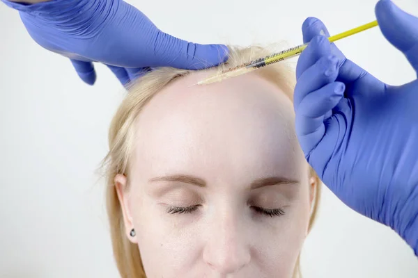 头发中移或头发移植 美容医生在女性头部注射头发生长或防止秃发 — 图库照片
