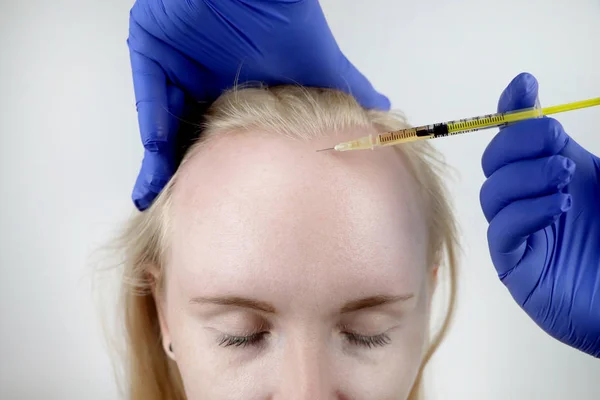 Haar Mesotherapie Haartransplantatie Een Schoonheidsspecialiste Arts Maakt Injecties Het Hoofd — Stockfoto