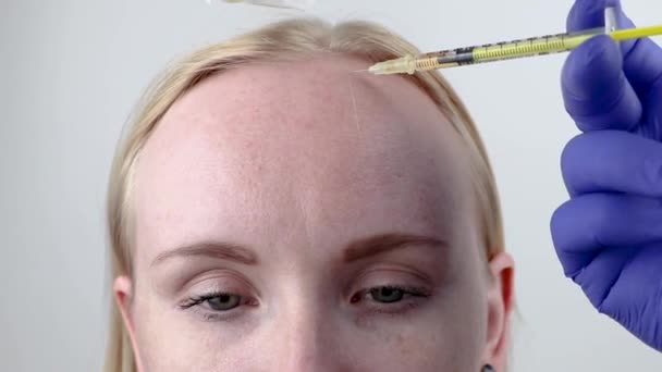 Haarmesotherapie Oder Haartransplantation Ein Kosmetikerin Arzt Macht Injektionen Den Kopf — Stockvideo