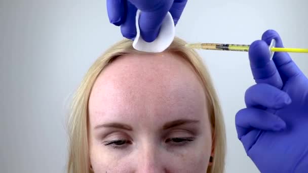 头发中移或头发移植 美容医生在女性头部注射头发生长或防止秃发 — 图库视频影像