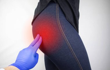 Bir kadın kalça ağrısından muzdariptir. Doktor hastaya piriforis sendromu, siyatik sinir, bel osteokondrosis ya da siyatik teşhisi koyuyor.