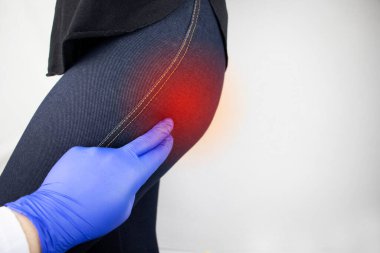 Bir kadın kalça ağrısından muzdariptir. Doktor hastaya piriforis sendromu, siyatik sinir, bel osteokondrosis ya da siyatik teşhisi koyuyor.