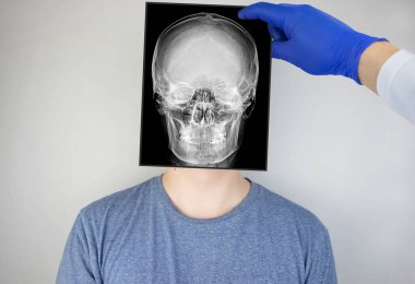 Bir adamın kafatasının radyografisini araştır. Bir doktor radyoloji uzmanı röntgen incelemesi yapıyor. Kafatasının bir görüntüsü hastaların kafasına yerleştirilir.