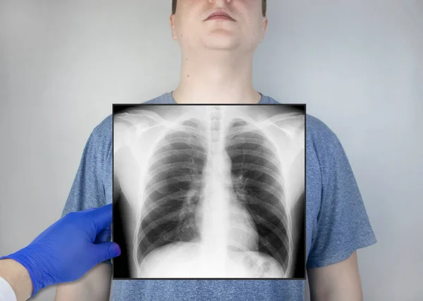 Ray Chest Man Doctor Radiologist Studying Ray Examination Picture Organs — Stock Photo, Image