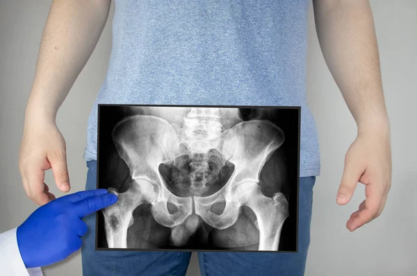 X ray of the pelvic bones of a man. A doctor radiologist is studying an x-ray examination. A hip joint is placed on the patients body