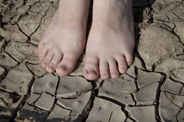 Kadının bacakları çatlamış toprakta duruyor. Ayakların kuru derisi ve nem ve mantar hastalıkları kavramı.