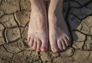 Kadının bacakları çatlamış toprakta duruyor. Ayakların kuru derisi ve nem ve mantar hastalıkları kavramı.