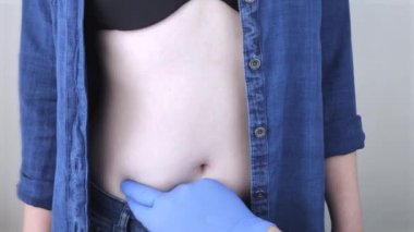 Bir kadın apandisitinde ağrıdan muzdarip. Akut apandisit, Crohn hastalığı ya da iltihaplı bağırsak hastalığı. Cerrah muayenesi ve laparoskopik apandisit ameliyatı hazırlığı.