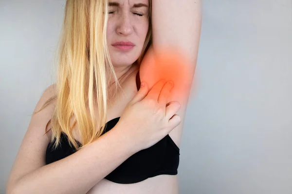 Eine Frau Leidet Unter Schmerzen Der Achselhöhle Schweißausbrüche Unangenehmer Geruch — Stockfoto