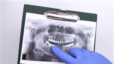 Bir dişçi doktor, dişleri ve problemleri olan bir hastanın dişlerinin fotoğrafını inceler. Araştırma ve tanı konsepti. Makro video