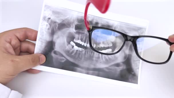 Medico Dentista Esamina Una Fotografia Dei Denti Paziente Che Problemi — Video Stock