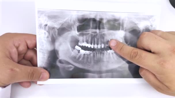 Dentist Doctor Examines Photograph Teeth Patient Who Has Problems Teeth — Stock Video