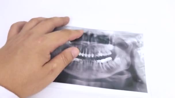 Médico Dentista Examina Una Fotografía Los Dientes Paciente Que Tiene — Vídeo de stock