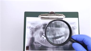 Bir dişçi doktor, dişleri ve problemleri olan bir hastanın dişlerinin fotoğrafını inceler. Araştırma ve tanı konsepti. Makro video
