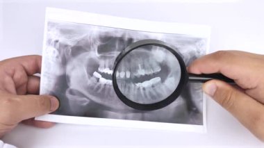 Bir dişçi doktor, dişleri ve problemleri olan bir hastanın dişlerinin fotoğrafını inceler. Araştırma ve tanı konsepti. Makro video