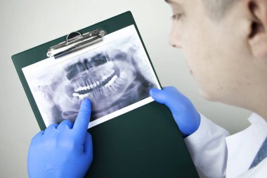 Bir dişçi doktor, dişleri ve problemleri olan bir hastanın dişlerinin radyografisini inceler. Araştırma ve tanı konsepti