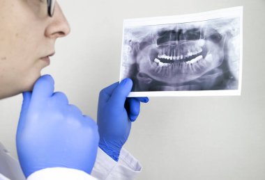 Bir dişçi doktor, dişleri ve problemleri olan bir hastanın dişlerinin radyografisini inceler. Araştırma ve tanı konsepti