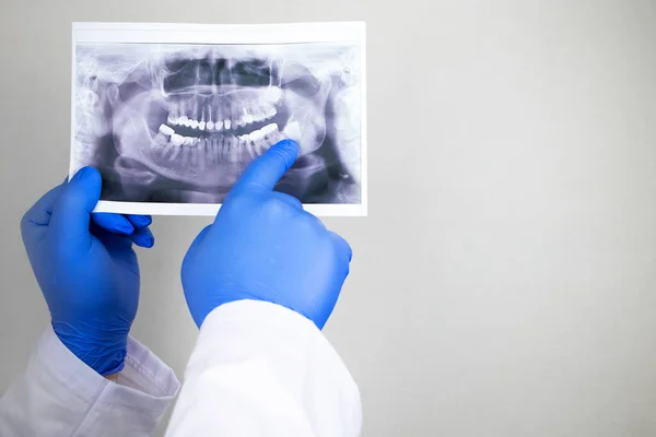 Médico Dentista Examina Una Radiografía Los Dientes Paciente Que Tiene — Foto de Stock