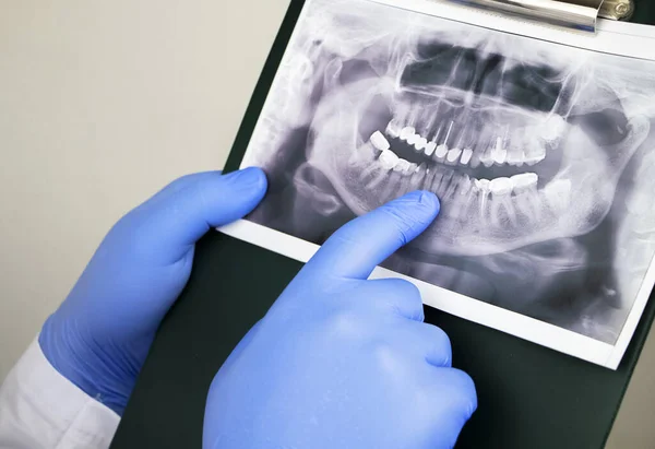 Médico Dentista Examina Una Radiografía Los Dientes Paciente Que Tiene — Foto de Stock