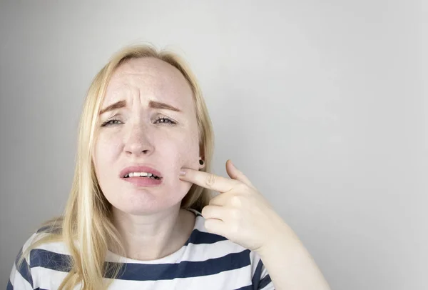 Kobieta Przylgnęła Jego Policzka Mrugnęła Bólu Zęba Koncepcja Problemów Stomatologicznych — Zdjęcie stockowe