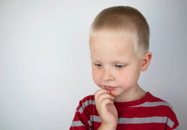 Een Allergist Dermatoloog Onderzoekt Rode Vlekken Het Gezicht Van Een — Stockfoto