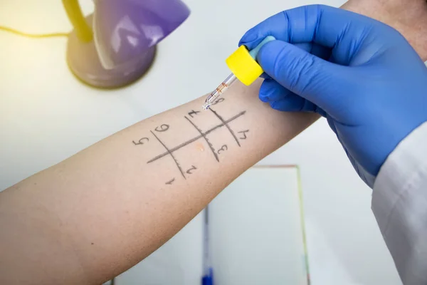 Allergist Doctor Laboratory Conducts Prik Allergy Test Skin Test Household — Stock Photo, Image