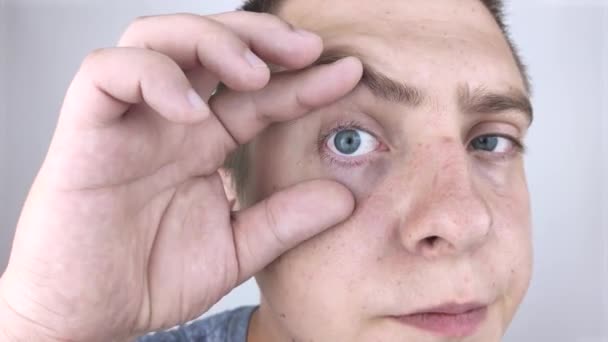 Gros Plan Deux Yeux Rouges Ennuyés Sang Masculin Affecté Par — Video