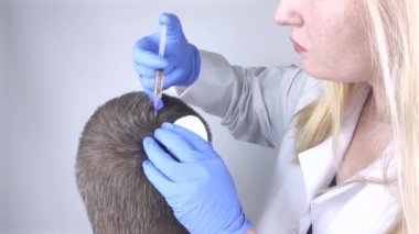 Doktor trichologist mezoterapi ya da plazma terapisi yapıyor. Alopecia tedavisi. Saç dökülmesi, alopezi, pruritus, yanmakta olan kafa ya da sebora.