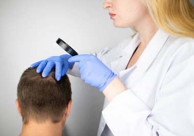 Bir tricholog, saç dökülmesine başlayan bir adamın saçını inceliyor. Bir dermatologla görüşeceğim. Saç dökülmesi, alopezi, pruritus, yanmakta olan kafa ya da sebora.