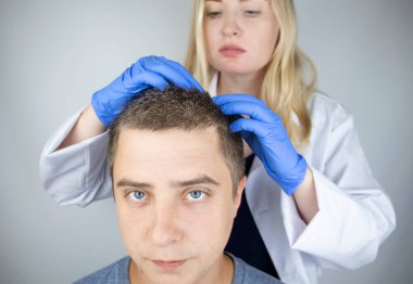 Bir tricholog, saç dökülmesine başlayan bir adamın saçını inceliyor. Bir dermatologla görüşeceğim. Saç dökülmesi, alopezi, pruritus, yanmakta olan kafa ya da sebora.