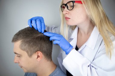 Bir tricholog, saç dökülmesine başlayan bir adamın saçını inceliyor. Bir dermatologla görüşeceğim. Saç dökülmesi, alopezi, pruritus, yanmakta olan kafa ya da sebora.