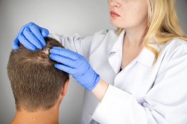Bir tricholog, saç dökülmesine başlayan bir adamın saçını inceliyor. Bir dermatologla görüşeceğim. Saç dökülmesi, alopezi, pruritus, yanmakta olan kafa ya da sebora.
