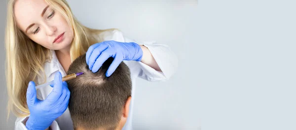 The doctor trichologist conducts mesotherapy or plasma therapy. Treatment of alopecia. Hair loss, alopecia, pruritus, burning head or seborrhea