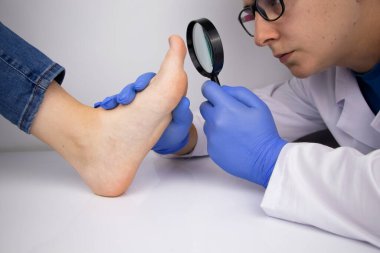 Bir tricholog ayak tırnağını mantardan etkilenen bir büyüteçle inceliyor. Mycosis tedavisi ve mantar hastalığı olan hastalara yardım.
