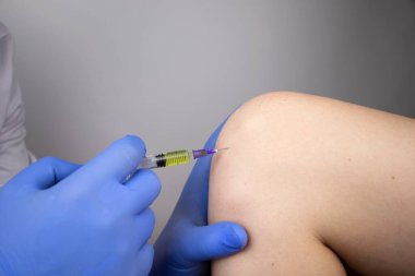 Bir ortopedi cerrahı dizine iğne yapar. Hyaluronik asite dayanan hormonal ilaçlarla ya da ilaçlarla osteoartrit tedavisi. Eklem kıkırdağına zarar veren hastalıklara yardım
