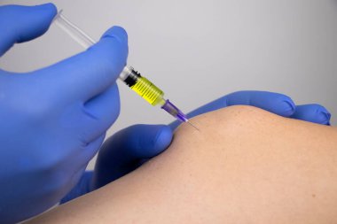 Bir ortopedi cerrahı dizine iğne yapar. Hyaluronik asite dayanan hormonal ilaçlarla ya da ilaçlarla osteoartrit tedavisi. Eklem kıkırdağına zarar veren hastalıklara yardım