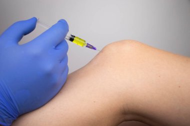 Bir ortopedi cerrahı dizine iğne yapar. Hyaluronik asite dayanan hormonal ilaçlarla ya da ilaçlarla osteoartrit tedavisi. Eklem kıkırdağına zarar veren hastalıklara yardım