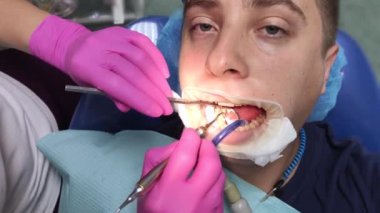 Diş hekimi dolguyla aletlerle çalışır. Bakım tedavisi, çürük bir dişin restorasyonu, profesyonel yardım, kanal dolgusu. Ağız ağrısı giderme kavramı