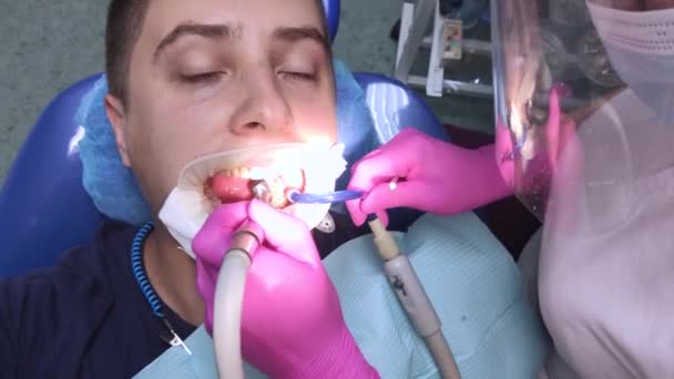 歯医者は満タンで道具を扱う 虫歯治療 衰えた歯の回復 専門家の助け 根管充填 口痛救済の概念 — ストック動画