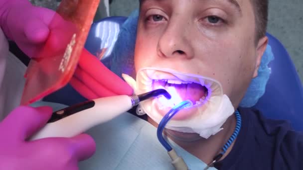 Dentysta Przymocuje Wypełnienie Światłem Pomocą Fotopolimerowej Lampy Bezprzewodowej Lekarz Świeci — Wideo stockowe