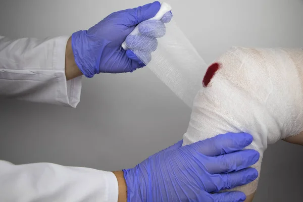 The doctor bandages the knee of a girl who is injured. Stopping bleeding by applying a pressure bandage to the injury. First aid for injuries. The technique of applying a cruciform bandage.