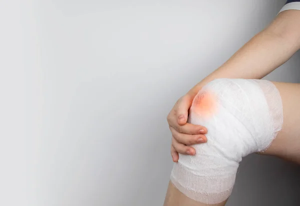 Der Arzt Bandagiert Das Knie Eines Verletzten Mädchens Stoppen Sie — Stockfoto