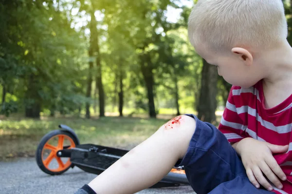 Een Vierjarige Jongen Viel Van Een Scooter Brak Zijn Knie — Stockfoto