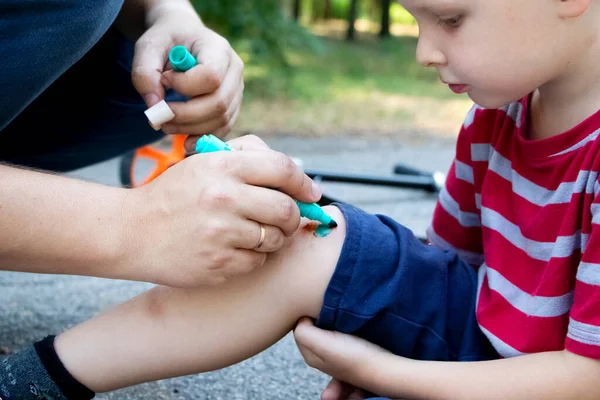 Four Year Old Boy Fell Scooter Broke His Knee Dad — Stock Photo, Image