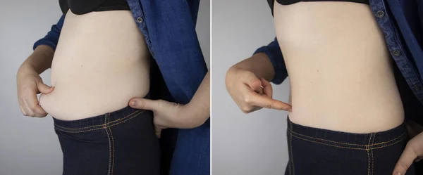 Menina Mostra Resultados Trabalho Corpo Antes Depois Uma Cintura Grossa — Fotografia de Stock