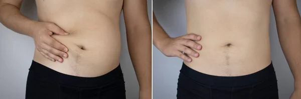 Homem Mostra Resultados Trabalho Corpo Antes Depois Uma Cintura Grossa — Fotografia de Stock